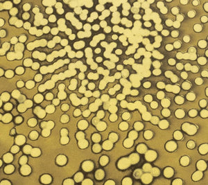 Ross Bleckner "Selection Sequence" Etching (9742318534963)