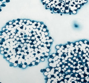 Ross Bleckner "Cluster" Etching and Aquatint (9742333346099)